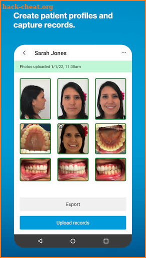 Invisalign Practice App screenshot