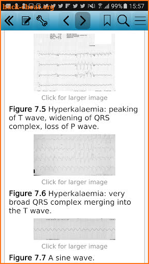 Kidney Disease Management screenshot