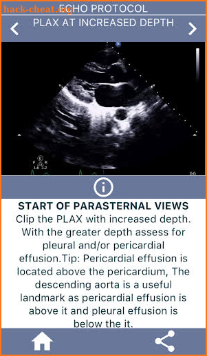 LEARN THE FULL TTE ECHO ULTRASOUND PROTOCOL screenshot