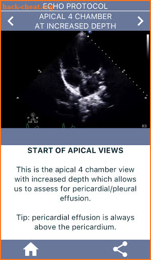 LEARN THE FULL TTE ECHO ULTRASOUND PROTOCOL DEMO screenshot