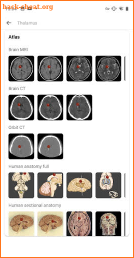 Medical Atlas - Medical Imaging & Radiology Tool screenshot