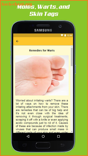 Mole Removal Remedies screenshot