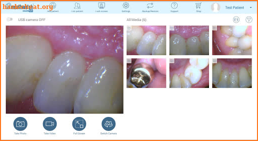 MouthWatch ExamTab screenshot