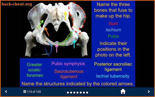 MSK Anatomy - SecondLook screenshot