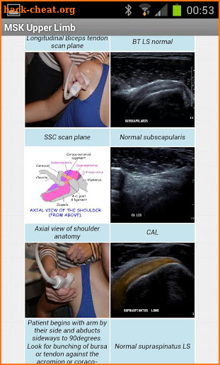 MSK ultrasound Upper Limb screenshot