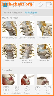 Muscle Premium - Human Anatomy, Kinesiology, Bones screenshot