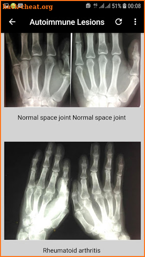 musculoskeletal x-ray interpretation screenshot