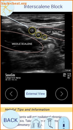 Nerve Block Star screenshot