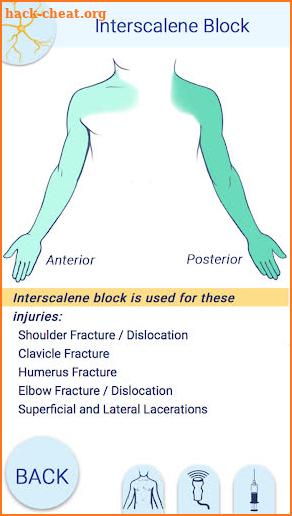 Nerve Block Star screenshot