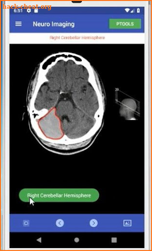 Neuro Imaging screenshot