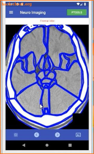 Neuro Imaging screenshot