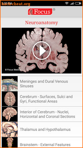 NEUROANATOMY - Digital Atlas screenshot