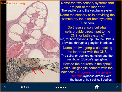 Neuroanatomy - SecondLook screenshot