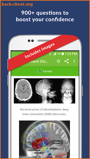 Neurology Exam Review & Practice Questions screenshot