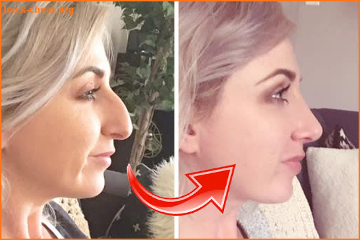 Nose Job Photo Editor screenshot