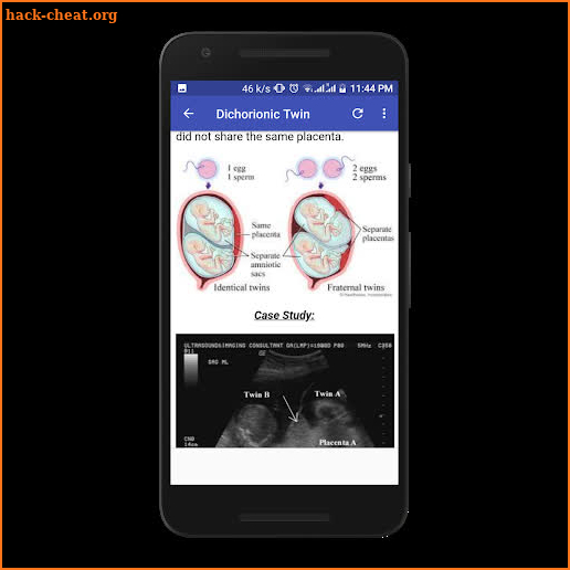 Obstetrics & Gyenacology Ultrasound Guide screenshot