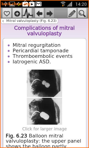 Oxford Handbook Cardiology 2 E screenshot