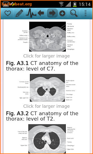 Oxford Handbook of Respira Med screenshot