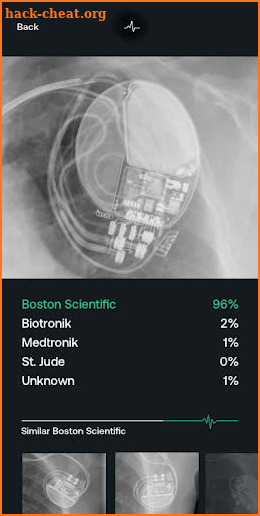 Pacemaker ID - Pacemakers and Defibrillators screenshot