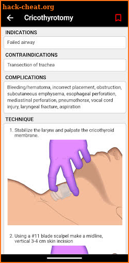 palmEM: Emergency Medicine screenshot