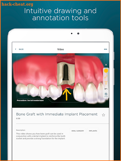 Patient Education screenshot