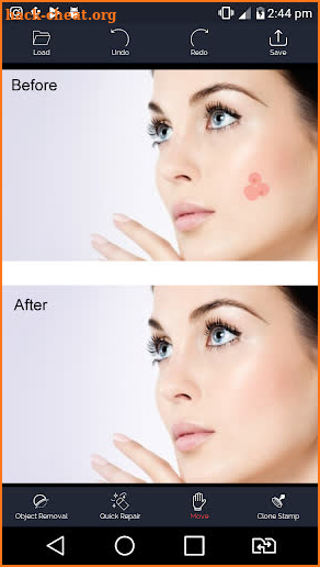 Photo Retouch - Blemish Remove screenshot