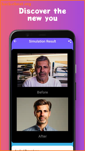 Plastic Surgery Simulator AI screenshot