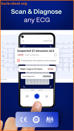 PMcardio - ECG Analysis screenshot