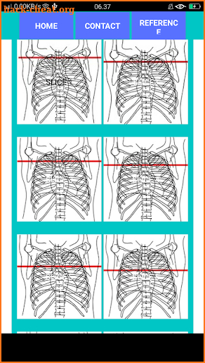 POCKET ATLAS CT THORAX screenshot