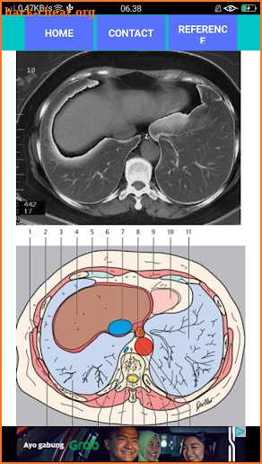 POCKET ATLAS CT THORAX screenshot