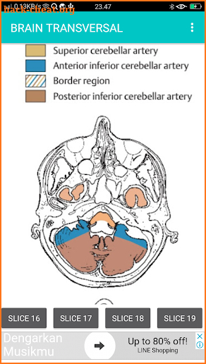 POCKET ATLAS MRI screenshot