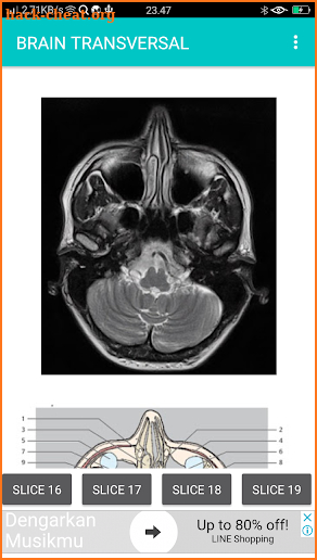 POCKET ATLAS MRI screenshot