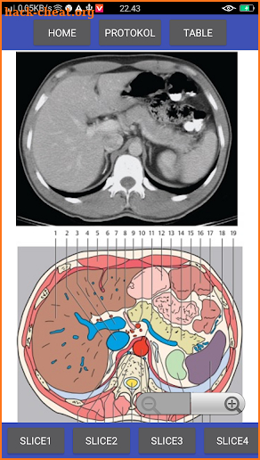 Pocket Atlas of CT ABDOMEN screenshot