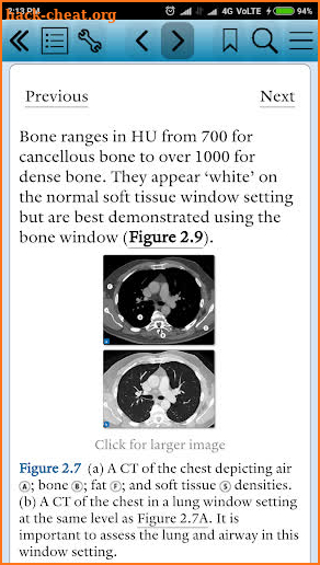 Pocket Tutor: Emergency Imaging screenshot