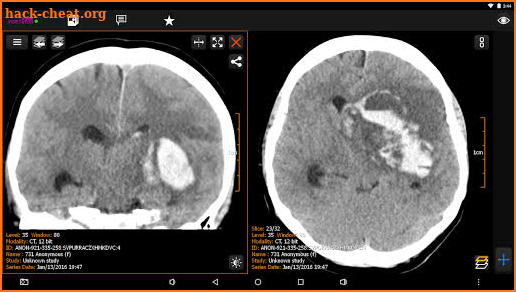 PORT-RAY: DICOM Viewer for Android screenshot