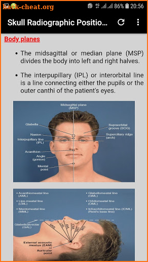 Positioning and Radiographic Anatomy of the Skull screenshot