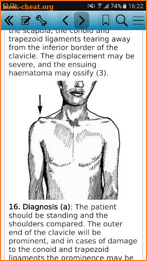 Practical Fracture Treatment 5 screenshot