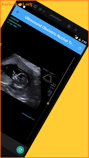 QXR Patient screenshot