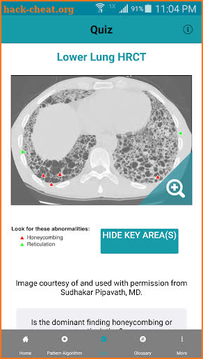 Rad Rounds - UIP to IPF screenshot