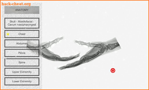 Radiographic Anatomy X-Ray screenshot