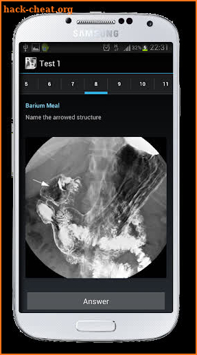 Radiological Anatomy For FRCR1 screenshot