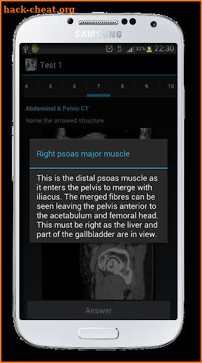 Radiological Anatomy For FRCR1 screenshot