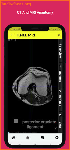 Radiology Anatomy CT And MRI screenshot