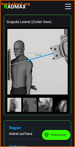 RadMax - Radiography Guide screenshot