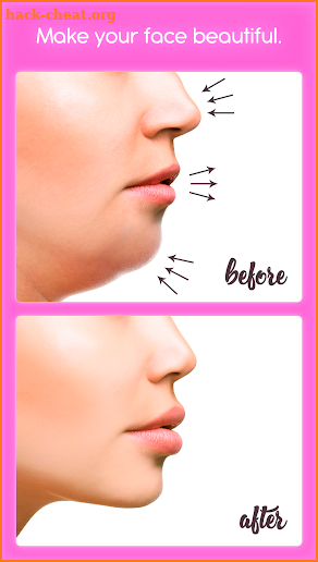 Rhinoplasty screenshot