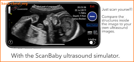 ScanBaby learn baby ultrasound screenshot