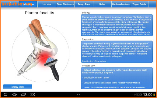 Shockwave Therapy screenshot