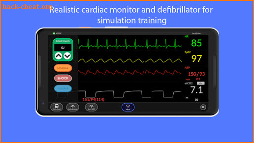 Simpl - Simulated Patient Monitor screenshot