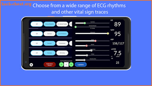 Simpl - Simulated Patient Monitor screenshot