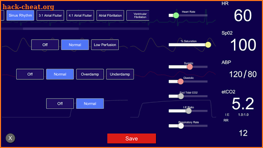 Simpl - Simulated Patient Monitor screenshot